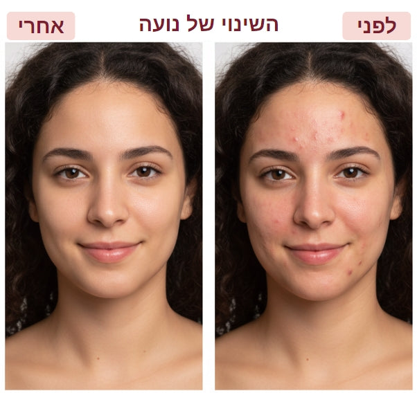 מסכת LED לבנה לטיפוח הפנים