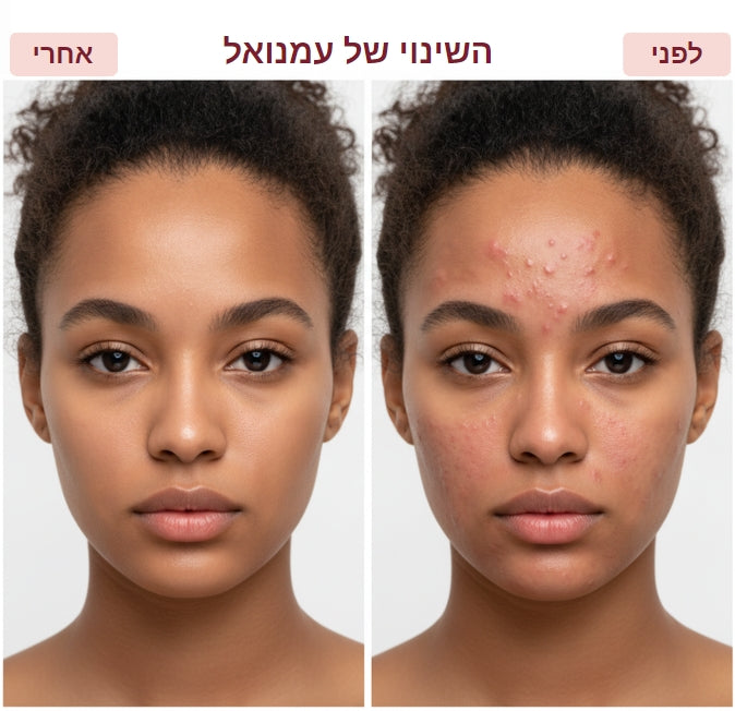 מסכת LED לבנה לטיפוח הפנים